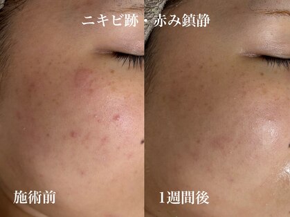 ミー(miii)の写真