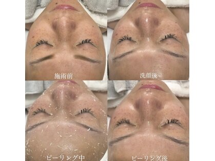 ポレ(pole)の写真