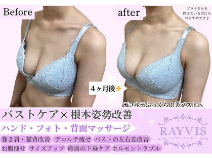 エステティック レイビス 青森店(RAYVIS)の写真