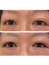 ナチュレ 武蔵浦和店(NATURE)/フラットラッシュ70本