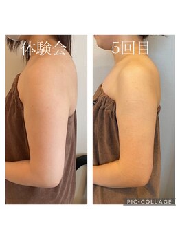 オードリリー(eau de Lily)/上半身の印象を変える！