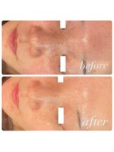 ラディエンス 多治見店/マーメイドセルトリートメント