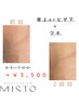 【脱毛】〈全員〉背上orヒザ下＋ワキ脱毛¥3,700→￥3,500！！
