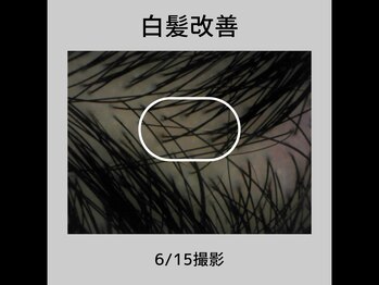 エルプラス(L+)/白髪改善