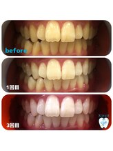 キラット 栃木店(Kiratt)/コーヒーをよく飲むお客様