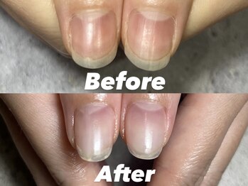 結(Yui)/自爪育成 Before→After