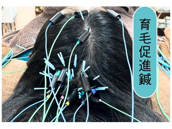 仁接骨院 じん鍼灸治療院/育毛促進鍼