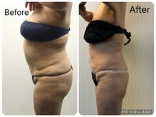 ラヴィアンローズ 津島店(La vie en Rose)/◇ビフォーアフター◇