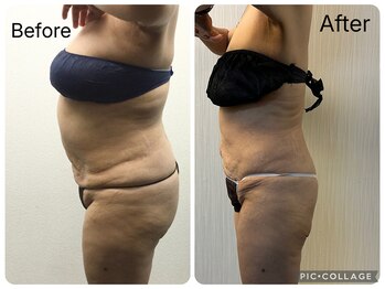 ラヴィアンローズ 津島店(La vie en Rose)/◇ビフォーアフター◇