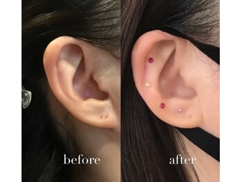 シロ(silo.)/耳ツボセラピー　before after
