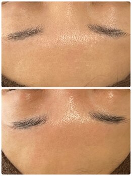 ナナラ(NANALA)/キメの細かいお肌を手に入れれる