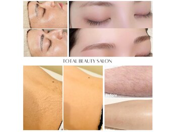 アールイー(Re:)