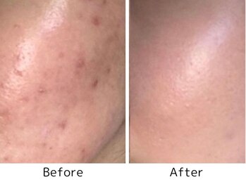 エープラス(A+)/ローズドメーラ