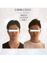 ビスイ 恵比寿(Bisui)/恵比寿/コルギ小顔矯正/毛穴ケア