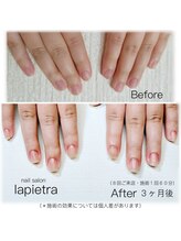 ネイルサロン ラピエトラ(la pietra)/最強のネイルケア３ケ月間コース