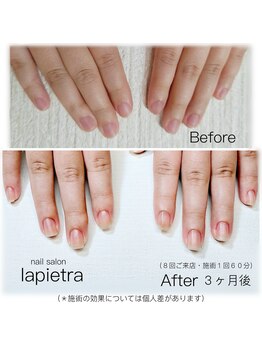 ネイルサロン ラピエトラ(la pietra)/最強のネイルケア3ケ月間コース