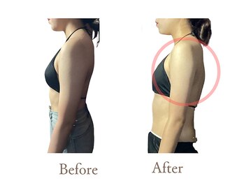 アダム(Adam)/横姿勢とバストライン