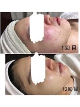 ビズビズ(bisebise)/