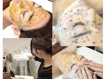 レア 姫路店(le'a)の写真/【艶肌WAXやハーブピーリングなど】毛穴洗浄やヒト幹細胞導入で韓国美人のような"水光艶肌"へ導きます♪