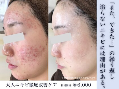 エピア 豊橋店(Epia)の写真