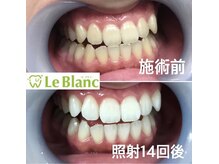 ルブラン 奈良店(Le Blanc)/3週間！リーズナブル！