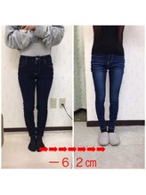 はるかぜ療術院/4ヶ月　－6.2センチ減！
