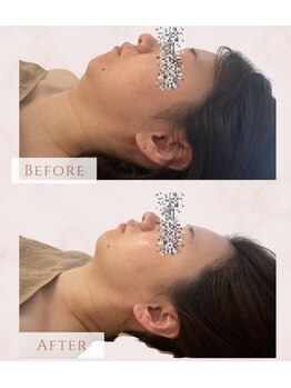 ソナ 大和西大寺院(SONA)/