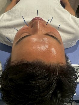 ビーワイ鍼灸整骨院 心斎橋院/メンズにもおすすめ♪