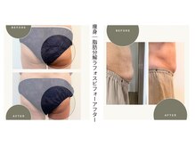 ビオン 松戸(bion)の雰囲気（痩せにくい身体を土台から整える）