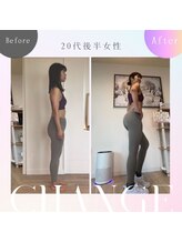 メモリア(memoria)/ヒップアップ　before/after