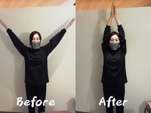クーオス(KuuOs)/【20代/女性】1回の施術後変化