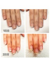 グレースレディ 神戸北店/