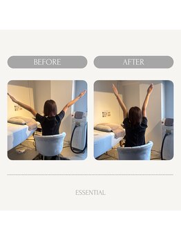 エッセンシャル 南海難波店(ESSENTIAL)/肩こり&巻き肩&猫背改善¥2,000