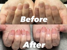 結(Yui)/自爪育成 Before→After