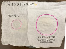 グランボヌール(grand bonheur)/【エレクトロクレンジング】