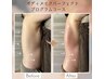 【背中・二の腕】Tシャツを綺麗に着たい!分厚い凝り＆ハミ肉撃退！上半身集中