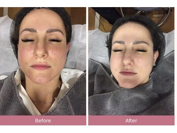エーエフビューティーエステ(AF Beauty Esthetic)の写真/完全個室・肌悩みに合わせて選ぶ、あなただけの肌質改善ケア。