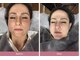 エーエフビューティーエステ(AF Beauty Esthetic)の写真/完全個室・肌悩みに合わせて選ぶ、あなただけの肌質改善ケア。