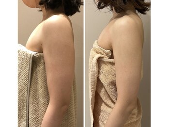 エイシスグロウ(asis glow.)/効果写真