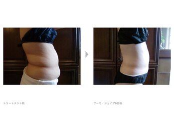 Nビューティー/最新エンダモロジーBODY