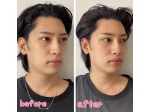 小顔整体 優/お顔が引き上がる！