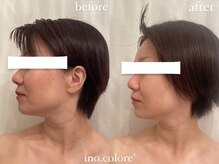 リノコロレ(ino.colore')/【人気No.1小顔コルギ】×1回