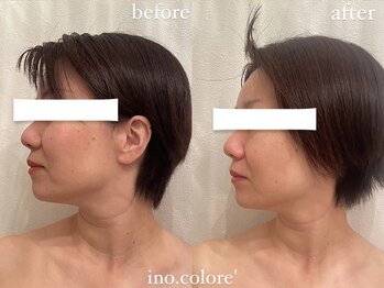 リノコロレ(ino.colore')/【人気No.1小顔コルギ】×1回