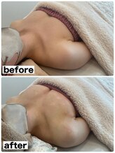 マイントゥー(mine too)/