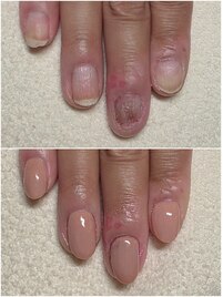 アピアランスネイル