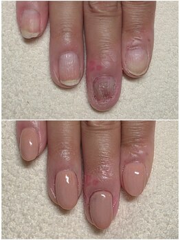 マニブルーム/アピアランスネイル