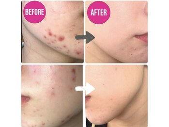 ラブランフェアリー/美肌もお任せください☆