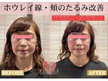 ヴィオーデ 弘前店/小顔、リンパ、ヘッドスパ、骨盤