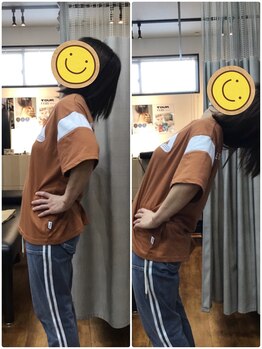 くすの樹接骨院 整体院 鳥栖院/整体/骨盤矯正ビフォーアフター