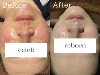 ココモンド(COCOMONDO)/セルマン艶肌ピーリング